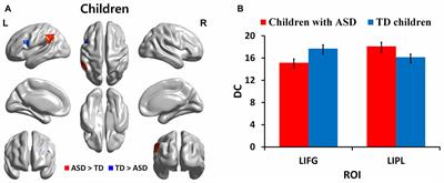 Autism Spectrum Disorder Related Functional Connectivity Changes in the Language Network in Children, Adolescents and Adults
